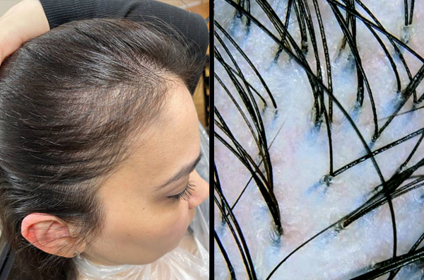 результаты за 4 мес