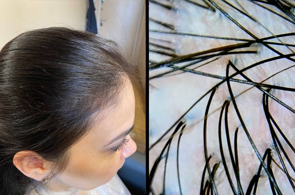 результаты за 4 мес