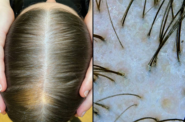 результаты за 4 мес